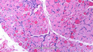 Demonstra a fisiopatologia