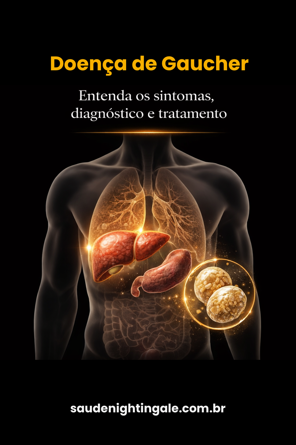 Doença de Gaucher: fisiopatologia, manifestações clínicas e cuidado contínuo