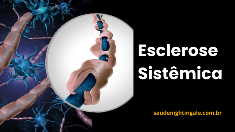 Esclerose Sistêmica: fisiopatologia, manifestações clínicas, diagnóstico e cuidado contínuo