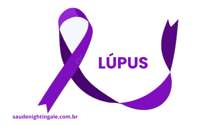 Lúpus Eritematoso Sistêmico: fisiopatologia, manifestações clínicas, diagnóstico e cuidado contínuo